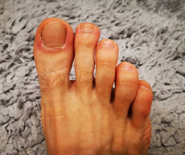 Foot
